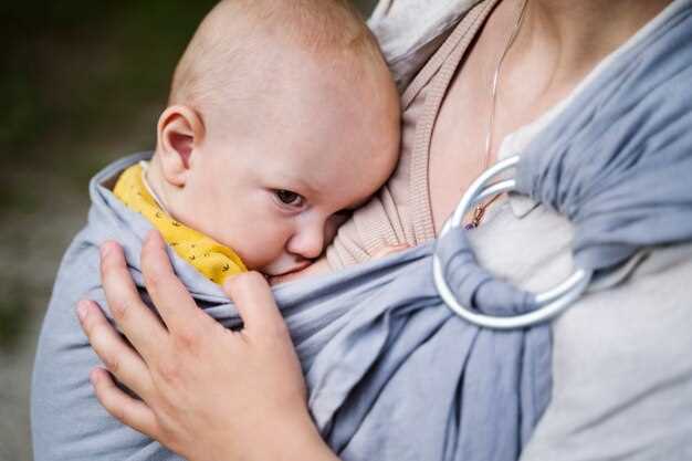 Физические признаки желтушки у новорожденных