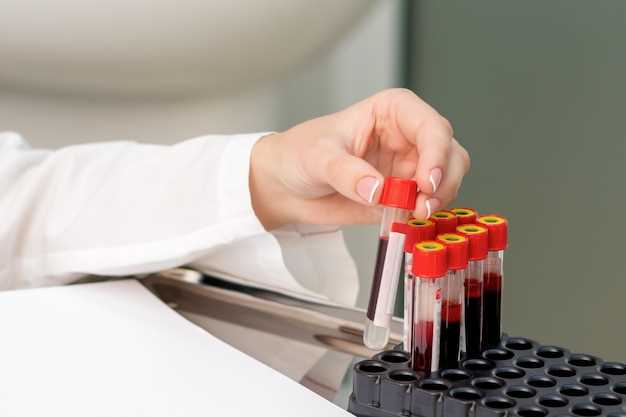 Основные рекомендации по периодичности сдачи крови на ВИЧ