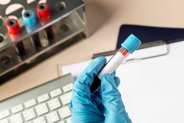 Важность регулярной проверки на ВИЧ и оптимальный срок сдачи крови
